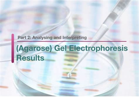 Part 2: Analysing and Interpreting (Agarose) Gel Electrophoresis .